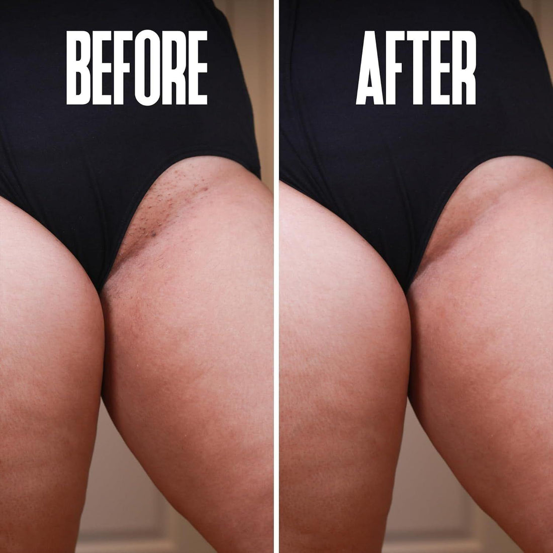 Divine Derriere Ingrown Hair Pads - 50 Pads | Exfoliating Razor Bump & Ingrown Hair Treatment