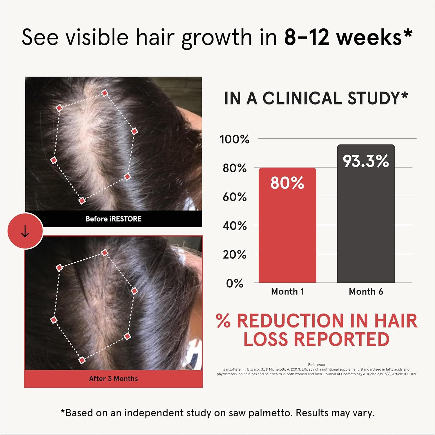 iRestore Hair Growth Formula 90 Capsules | 10,000mcg Biotin & DHT Blockers for Thicker, Fuller Hair