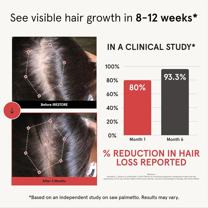 iRestore Hair Growth Formula 90 Capsules | 10,000mcg Biotin & DHT Blockers for Thicker, Fuller Hair