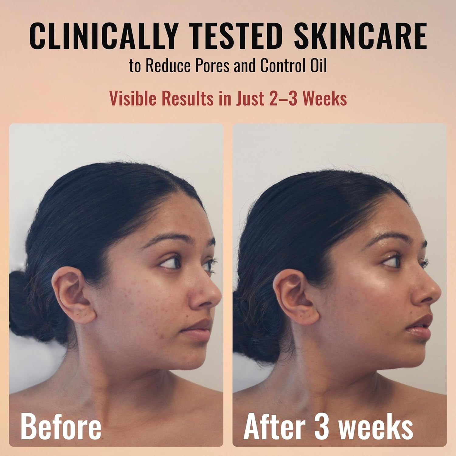 Amour De Moi Youth Renewing Anti-Aging Serum 30ml | Retinol + Niacinamide for Smoother, Brighter, Younger-Looking Skin