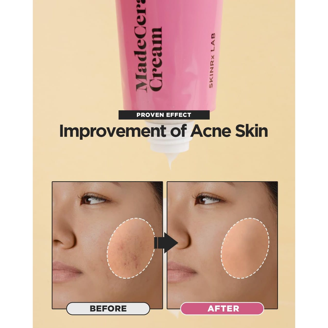 BEISIKS SKINRxLAB MadeCera Cream – 50ml | Intensive Moisturiser for Sensitive, Dry & Aging Skin