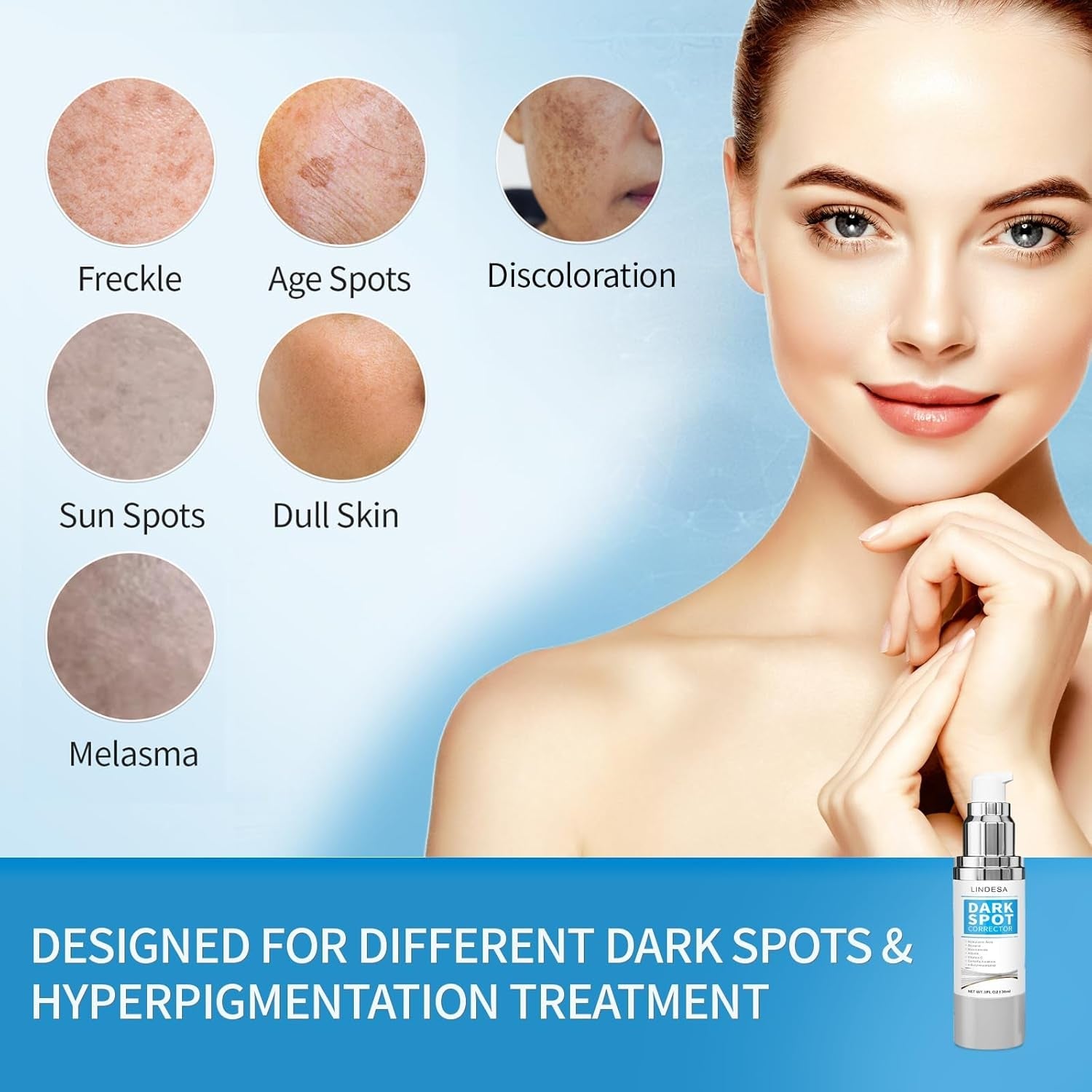 Lindesa Dark Spot Corrector – 30 ml | Advanced Serum for Hyperpigmentation, Melasma, Sun Spots & Uneven Skin Tone
