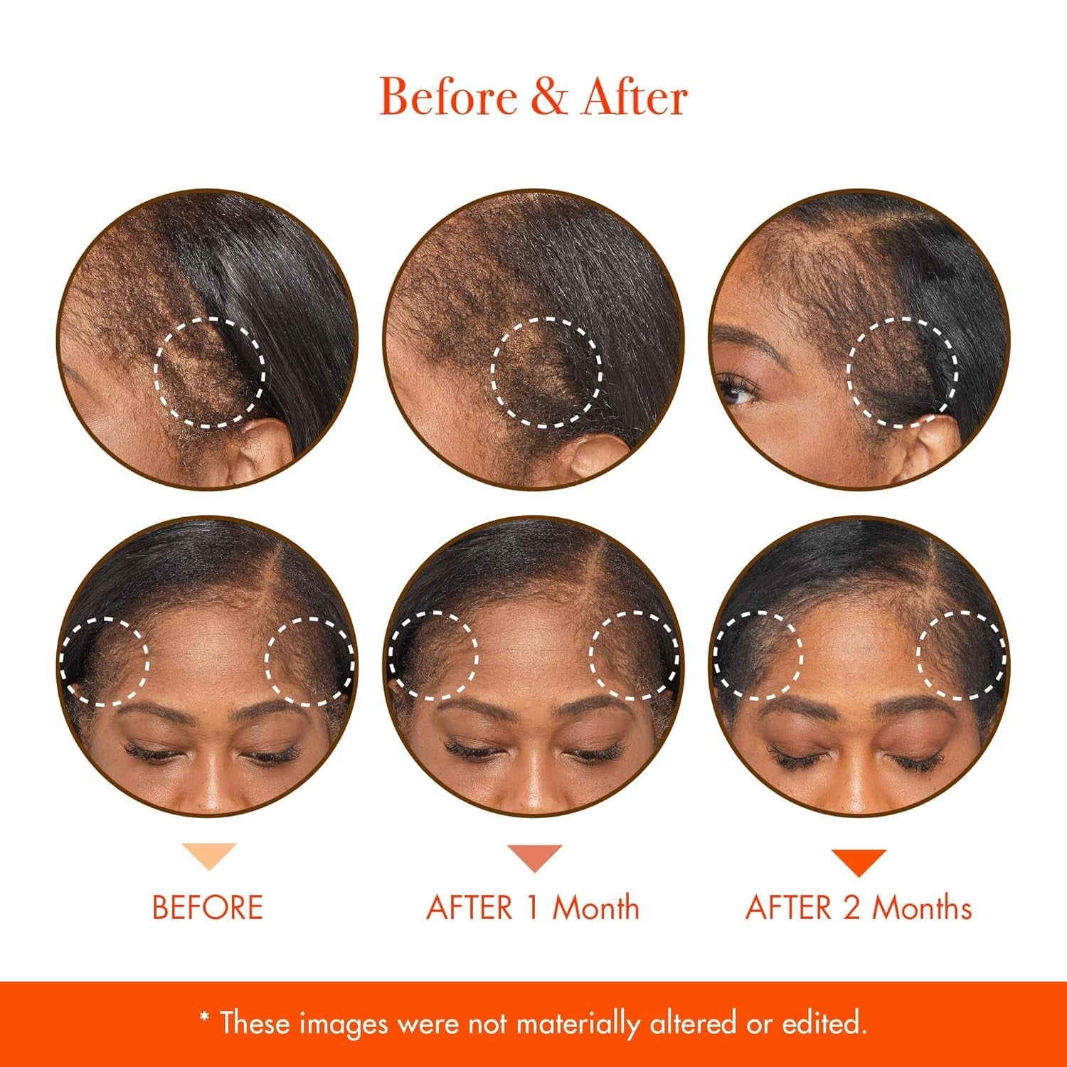 Red by Kiss Growth MD Scalp Serum – 59ml | Stimulates Hair Regrowth & Nourishes Dry Scalp