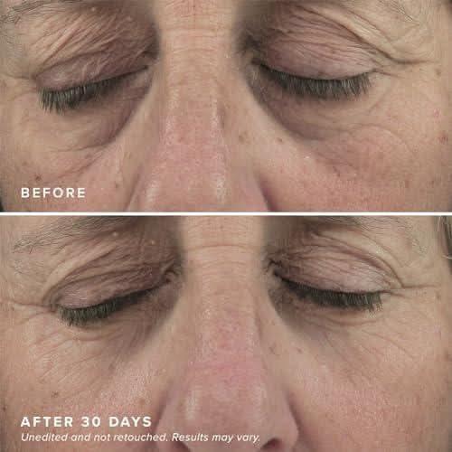 DRMTLGY Brightening Eye Masks 60 Under Eye Patches | Caffeine-Infused Hydration & Puffiness Reduction