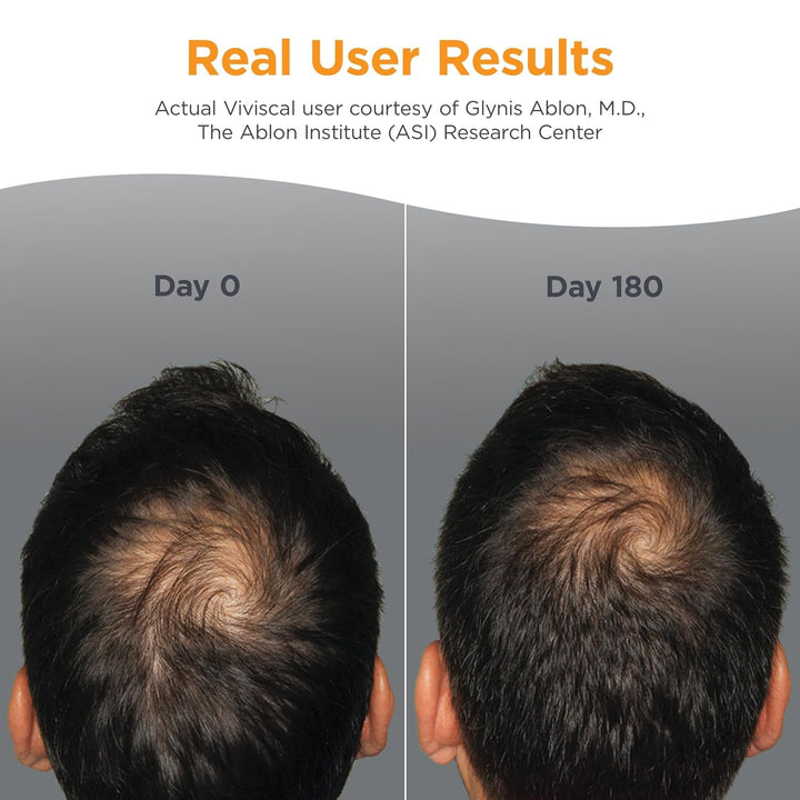Viviscal Man Advanced Hair Health – 60 Tablets Clinically Proven Drug-Free Hair Growth for Men