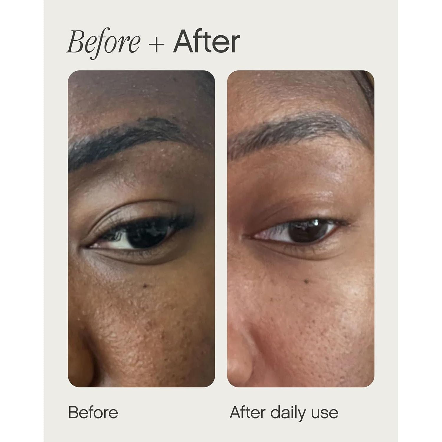 Topicals Sealed Active Scar Primer - 28ml | Instantly Smooths & Improves Scar Appearance