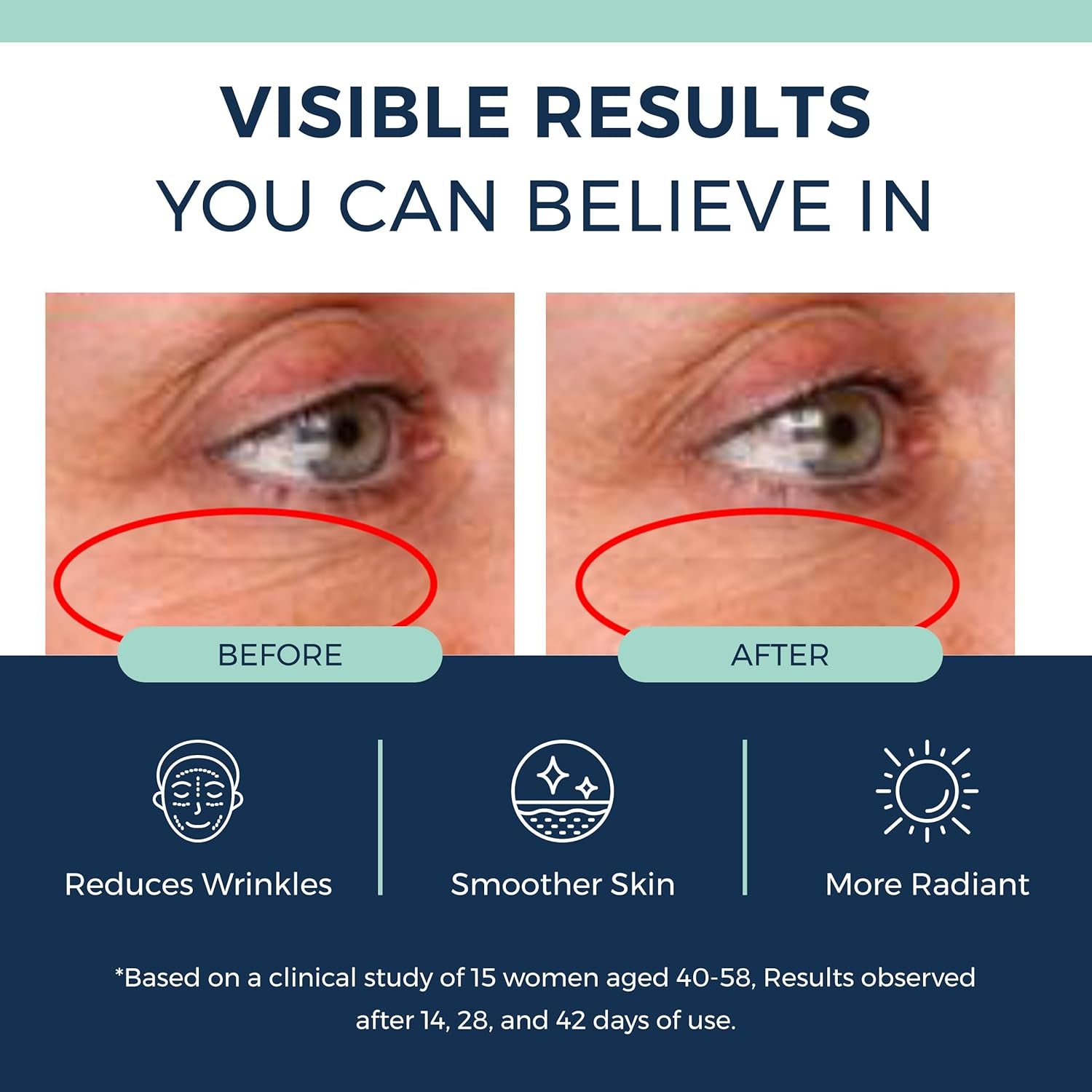 Clinexil Deep Wrinkle Resurfacing Retinol Serum – 30ml | 1% Dual Retinol for Smoother, Firmer & Brighter Skin