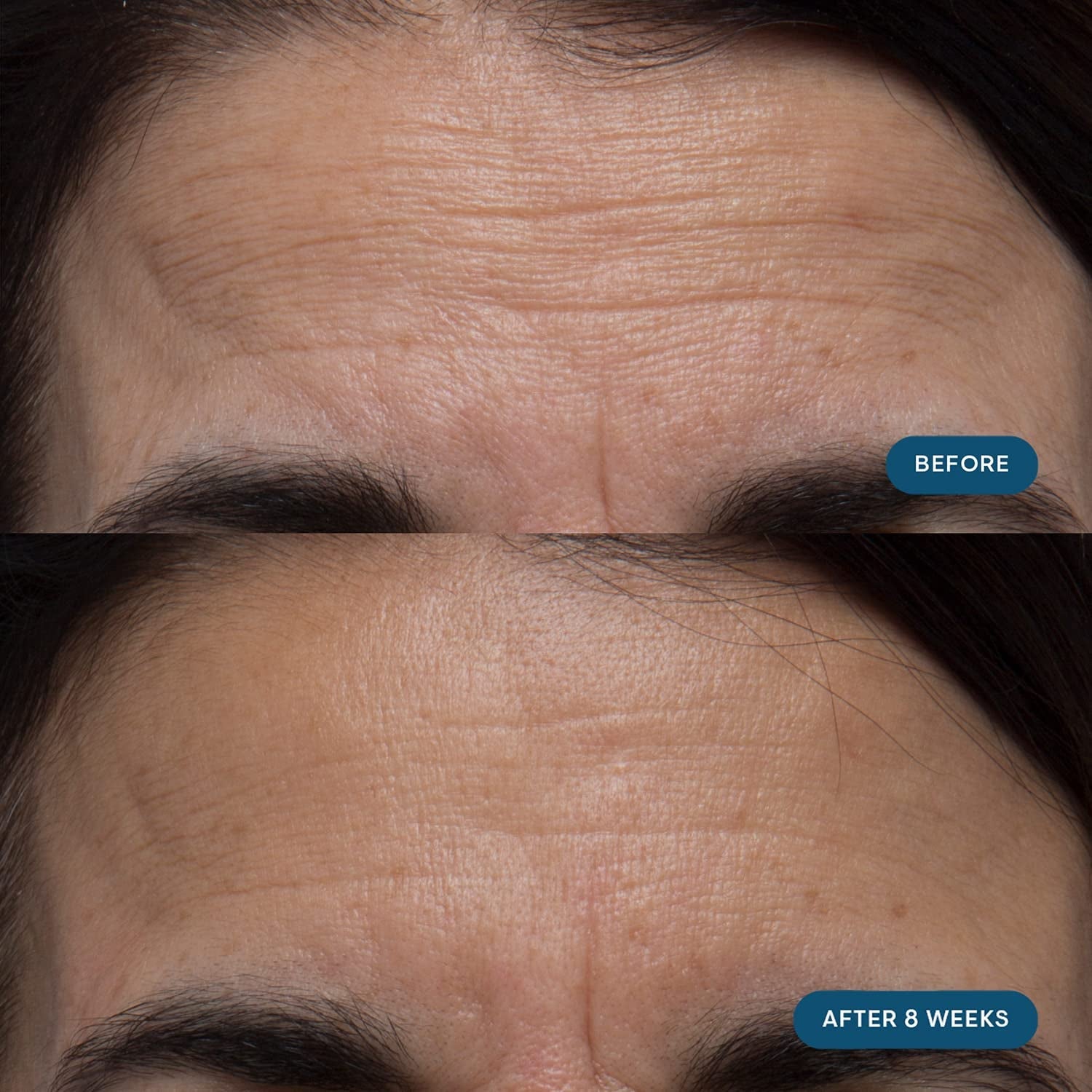 ELEMIS Pro-Collagen Skin Future Food Supplement 60 Capsules | Daily Skin Wellness from Within Support youthful, radiant skin from the inside out with ELEMIS Pro-Collagen Skin Future Food Supplement!