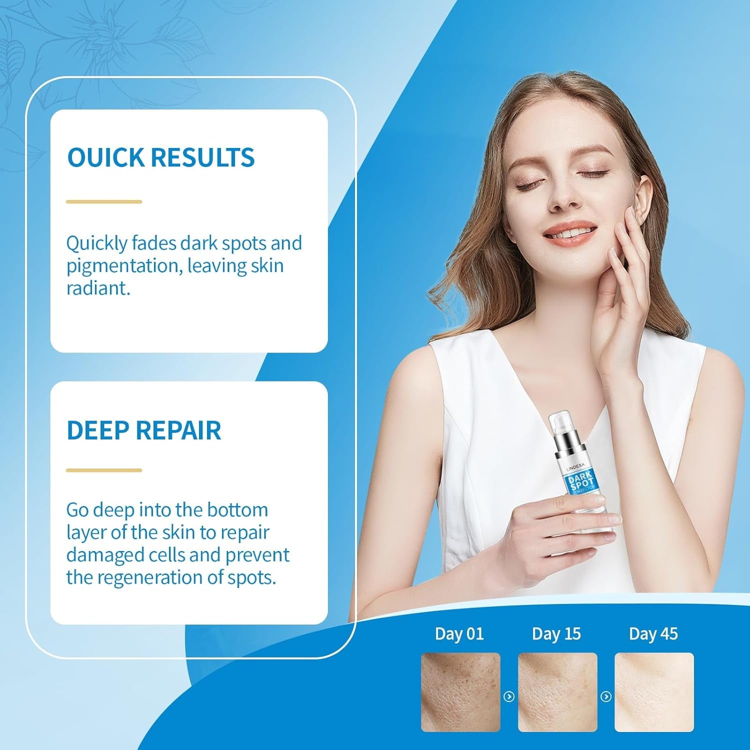 Lindesa Dark Spot Corrector – 30 ml | Advanced Serum for Hyperpigmentation, Melasma, Sun Spots & Uneven Skin Tone