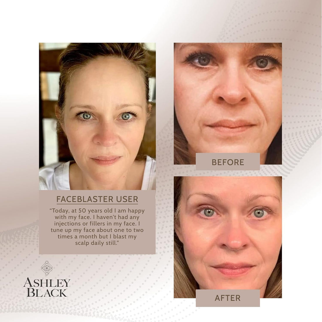 FasciaBlaster The FaceBlaster by Ashley Black | Targeted Facial Fascia Tool for Collagen Boosting & Skin Tightening