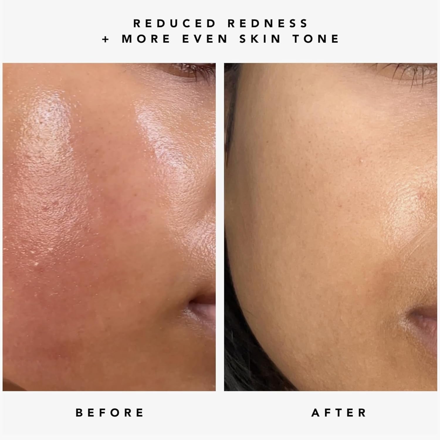 HERBIVORE Nova Brightening Serum – 30ml | Vitamin C + Turmeric for Radiant, Even-Toned Skin