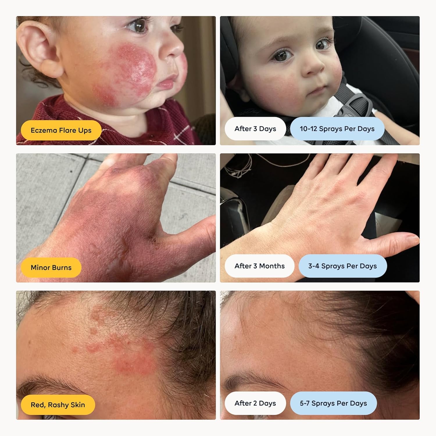 Magic Molecule Antimicrobial Skin Cleanser  62 ml (Pack of 3) | Gentle HOCl Formula for Face, Body & Tattoo Aftercare