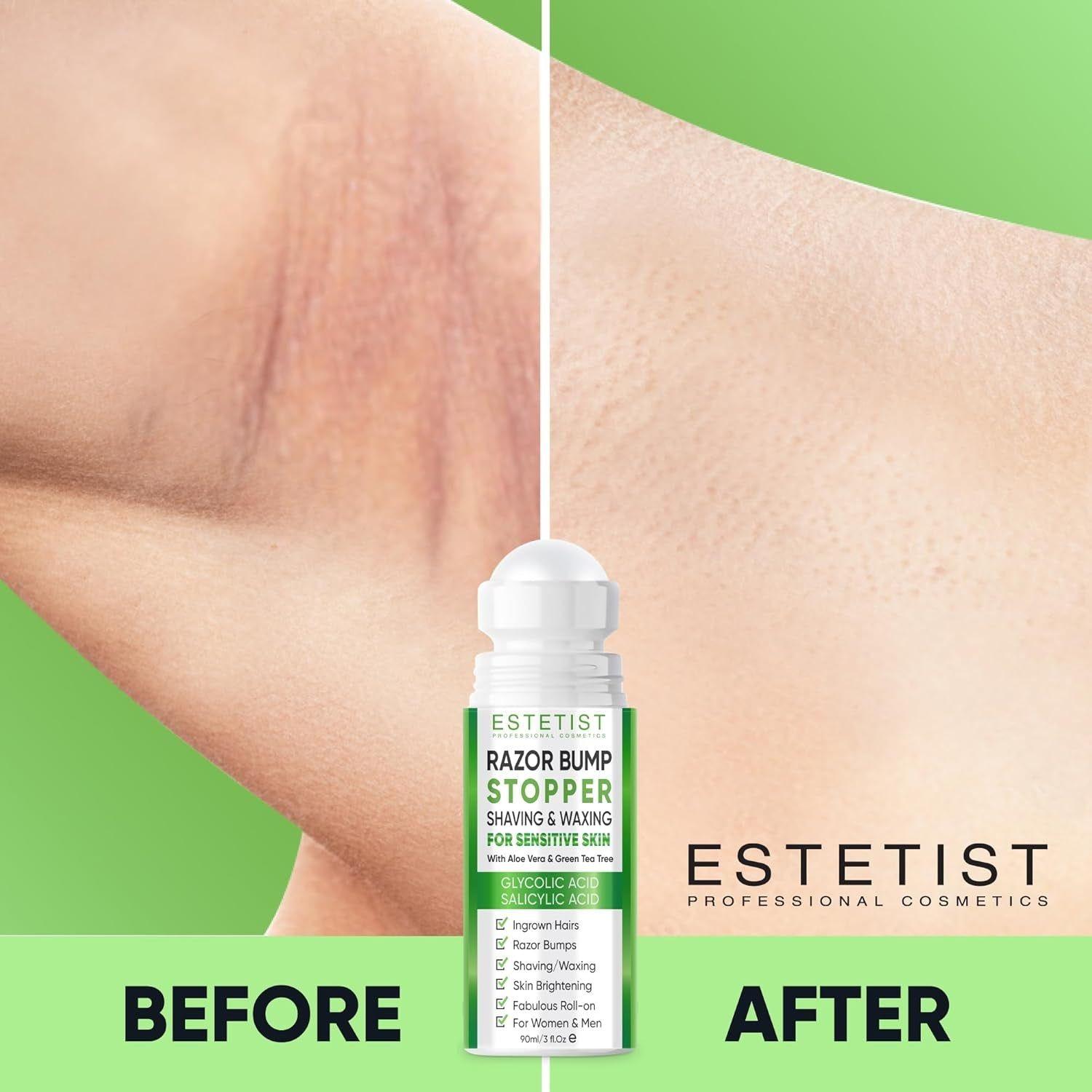 ESTETIST Razor Bump Stopper (Citrus Scent) - 90ml | Ingrown Hair & Razor Burn Solution for Sensitive Skin