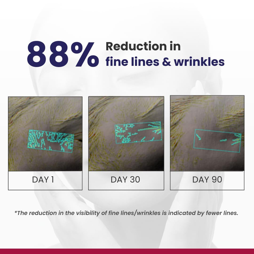 RE' EQUIL 0.1% Retinol Night Cream – 30g  The Dermatologist-Approved Retinol Revolution for Youthful Resurfaced Skin