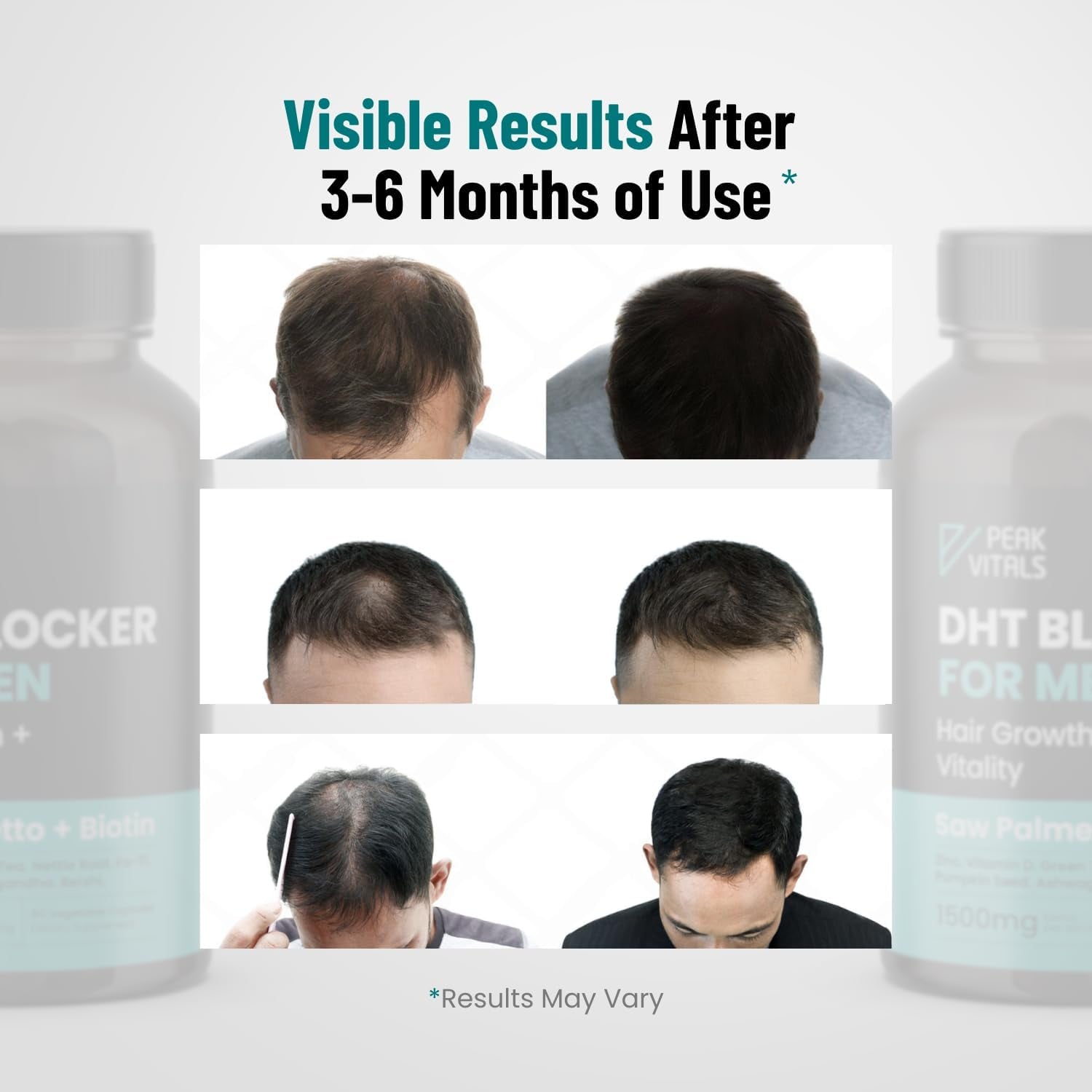 PEAK VITALS DHT Blocker for Men 90 Capsules The All-in-One Hair Regrowth & Vitality Supplement for Modern Men