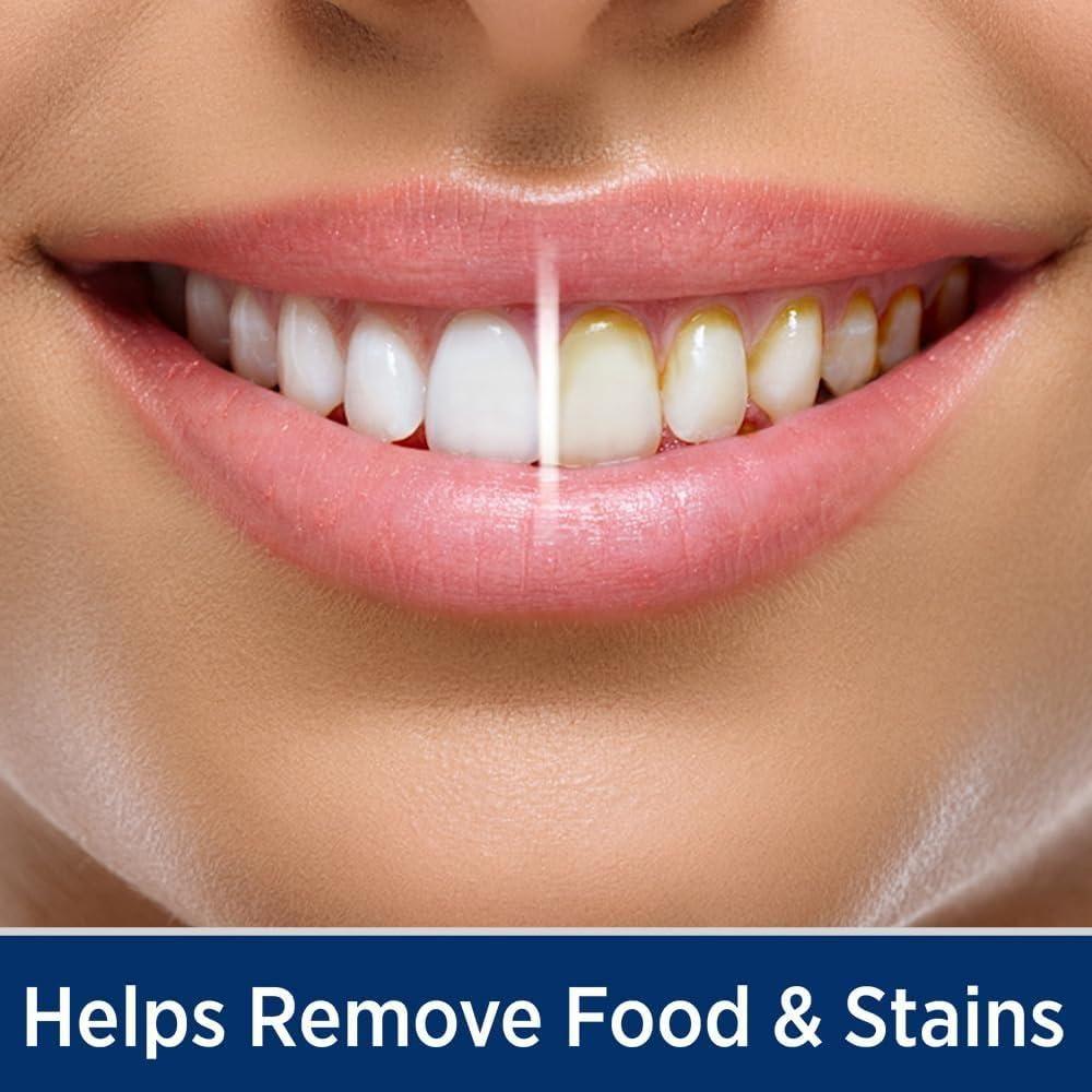 Ontel Miracle Smile Deluxe Pro Water Flosser | 360° Cleaning Technology for a Healthier Smile