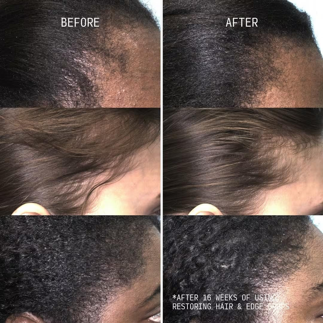 Cécred Restoring Hair & Edge Drops 50ml | Peptide-Infused Hair Serum for Fuller, Healthier Hair