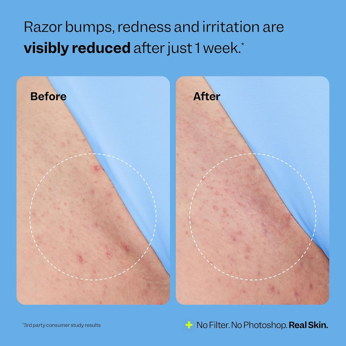Peach Slices Smoothing Solution Ingrown Hair Treatment 50ml | Clear Bumps, Soothe Redness & Brighten Dark Spots