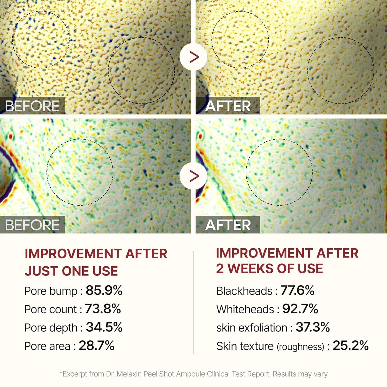 Dr.Melaxin Peel Shot Exfoliant Black Rice Ampoule 80ml | 4-in-1 Exfoliating Glow Booster with Niacinamide & Black Rice