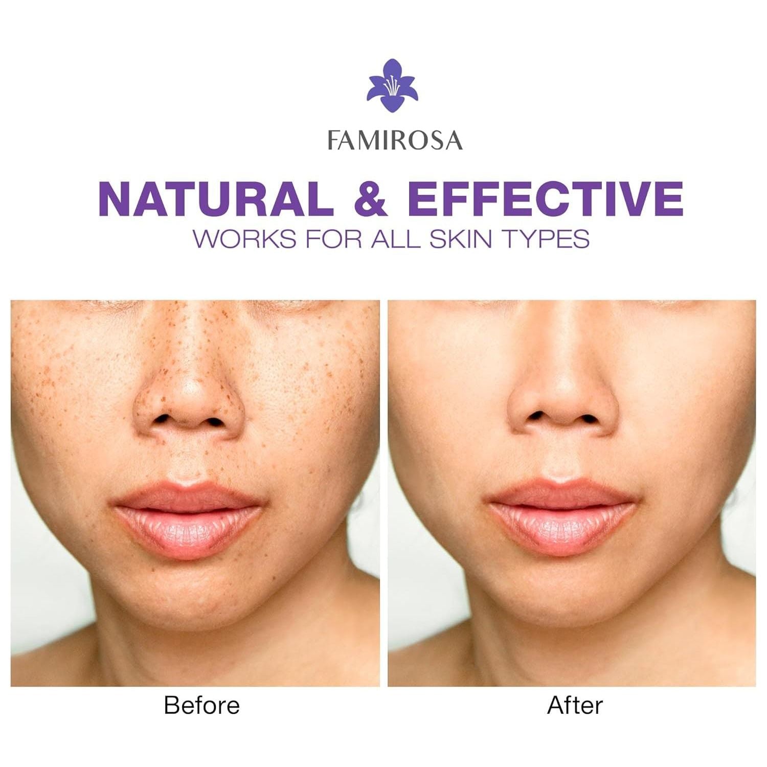 Farmirosa Dark Spot Corrector | Advanced Hyperpigmentation & Melasma Treatment for Face & Body Farmirosa