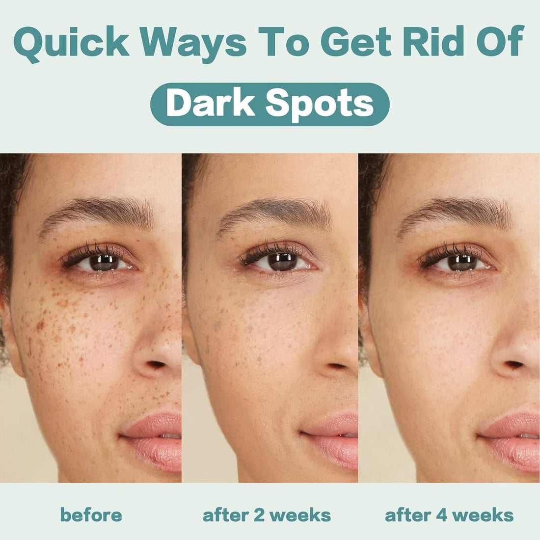 CITYGOO Dark Spot Corrector Cream - 50ml | Natural Ingredients for Even Skin Tone
