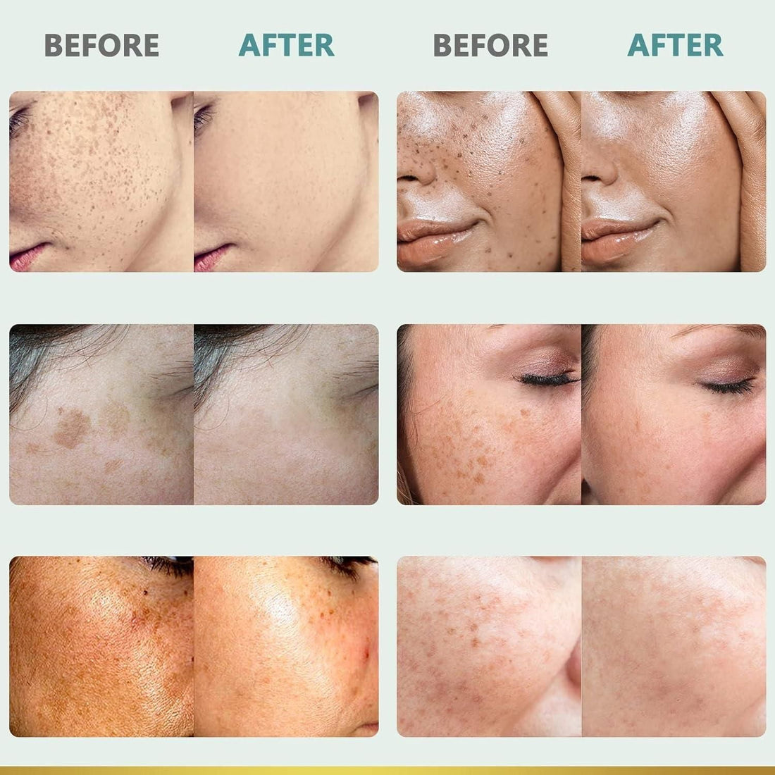 CITYGOO Dark Spot Corrector Cream - 50ml | Natural Ingredients for Even Skin Tone