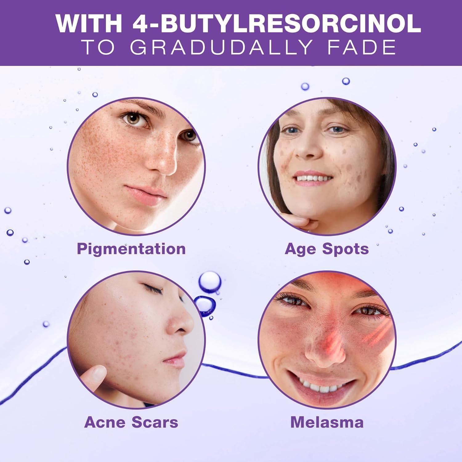 Farmirosa Dark Spot Corrector | Advanced Hyperpigmentation & Melasma Treatment for Face & Body Farmirosa