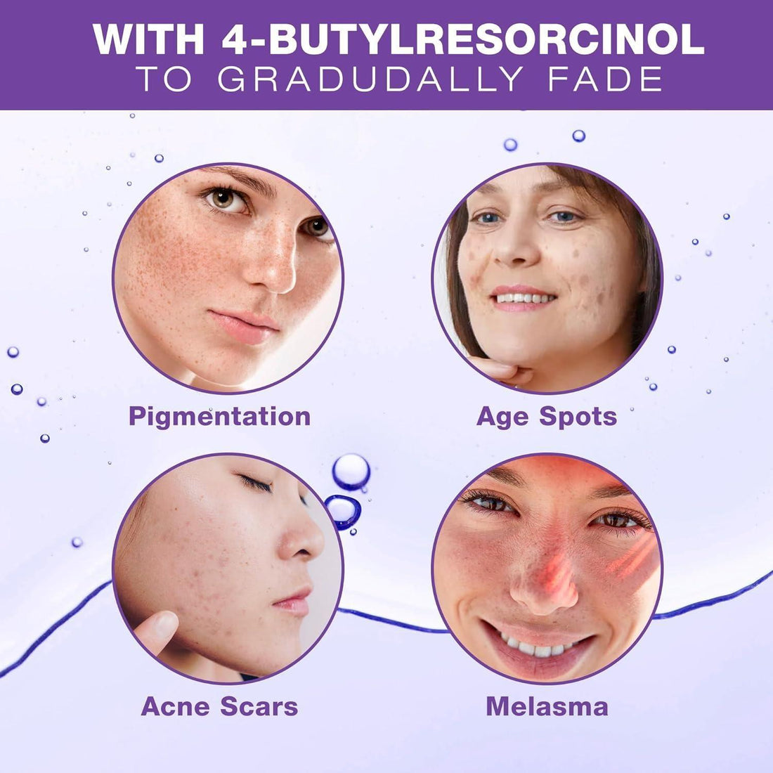 Farmirosa Dark Spot Corrector | Advanced Hyperpigmentation & Melasma Treatment for Face & Body Farmirosa