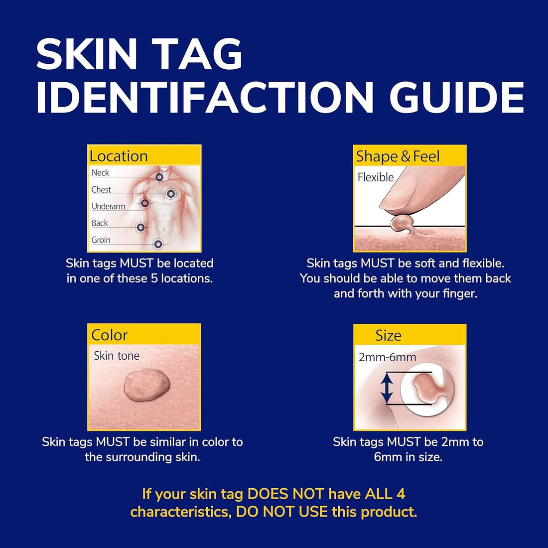 Dr. Scholl's Freeze Away Skin Tag Remover  8 Cryo Treatments, 53g | The FDA-Cleared At-Home Solution for Professional-Grade Skin Tag Removal