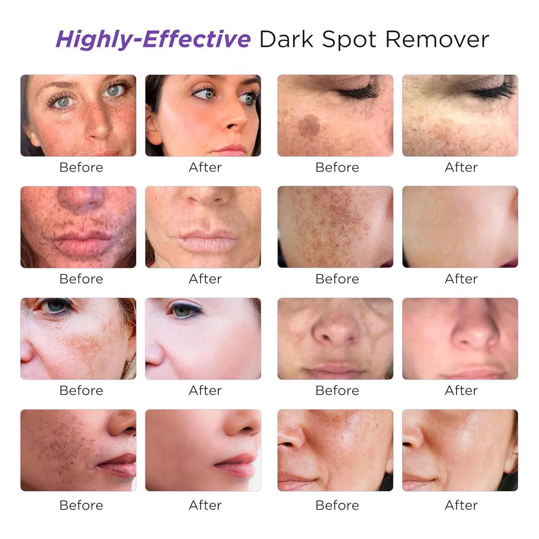 Farmirosa Dark Spot Corrector | Advanced Hyperpigmentation & Melasma Treatment for Face & Body Farmirosa