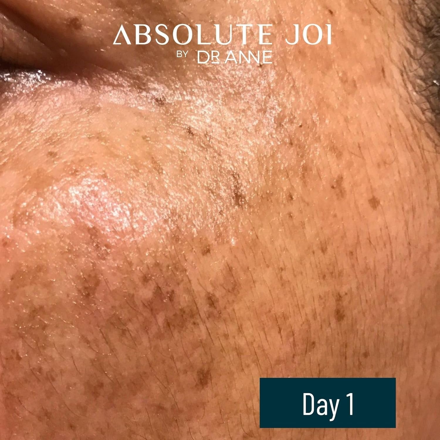 AbsoluteJOI Skin Refining Night Oil 30ml | Retinol + Vitamin C for Even Tone & Radiant Skin