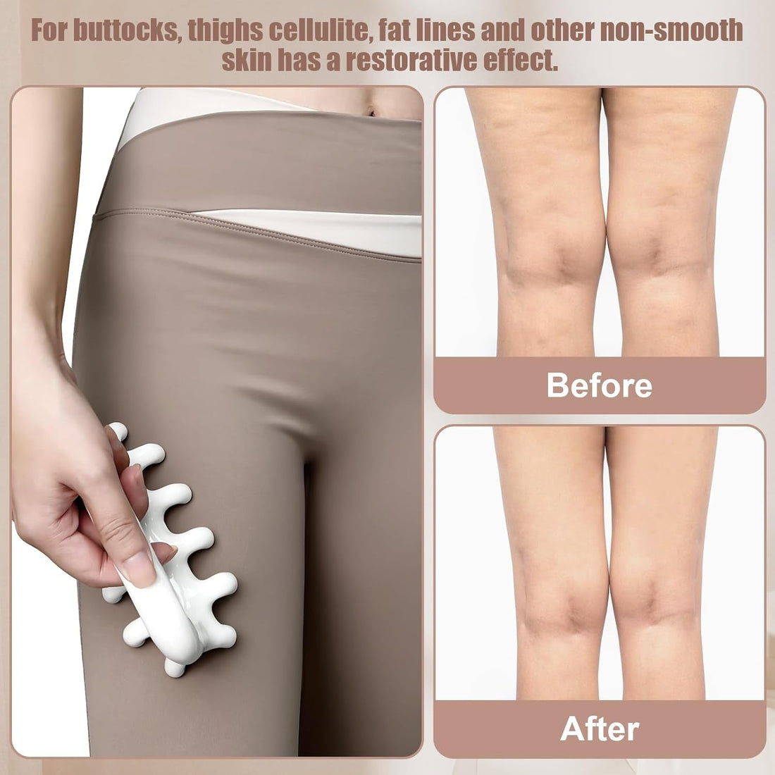 VEMOKY Fascia Release Massager Tool | Anti-Cellulite, Deep Tissue & Lymphatic Drainage Massage Roller