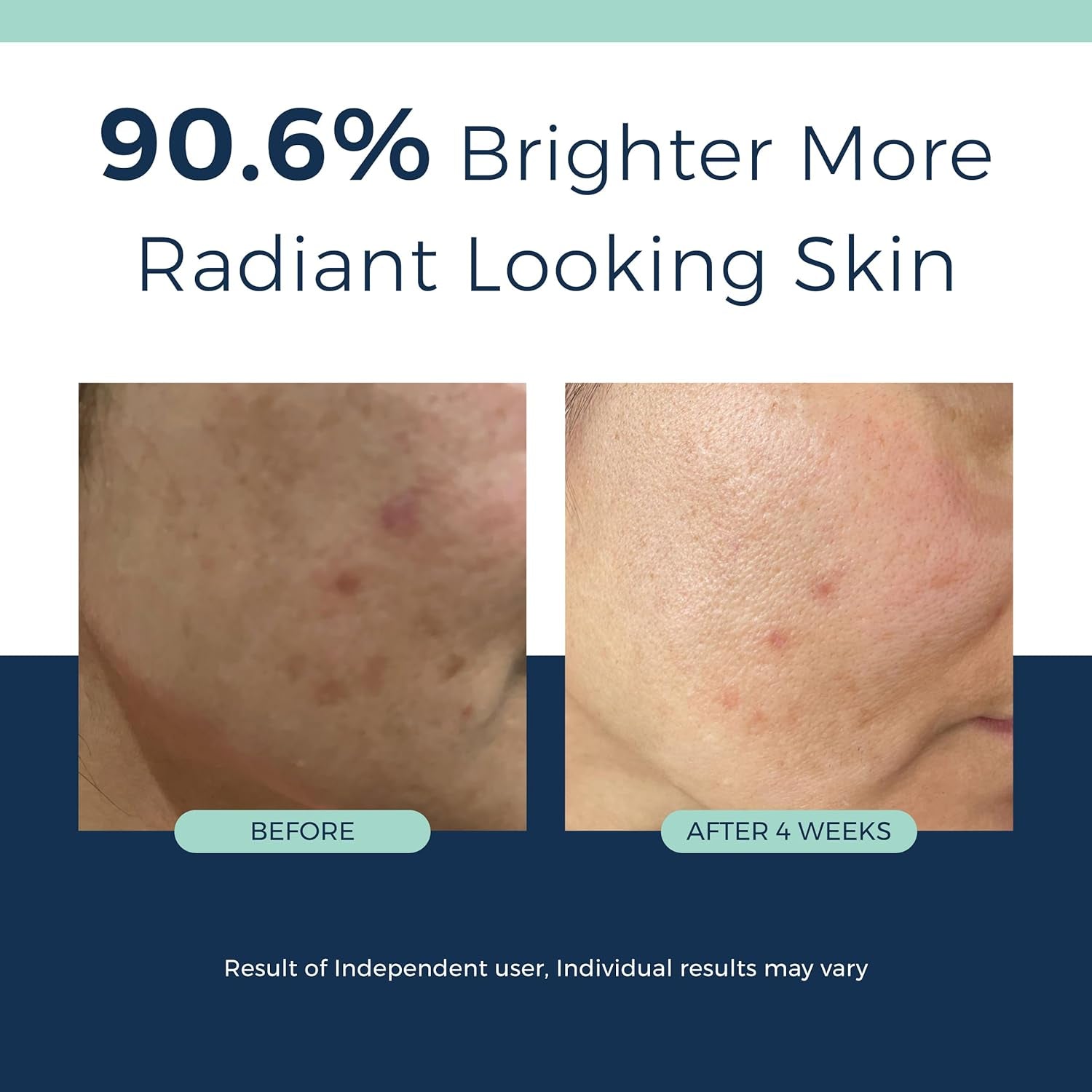 Clinexil Deep Wrinkle Resurfacing Retinol Serum – 30ml | 1% Dual Retinol for Smoother, Firmer & Brighter Skin