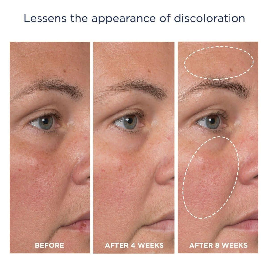 M-61 Advanced Essentials Four Step Skincare System | Clinically Proven Glow-Boosting Regimen