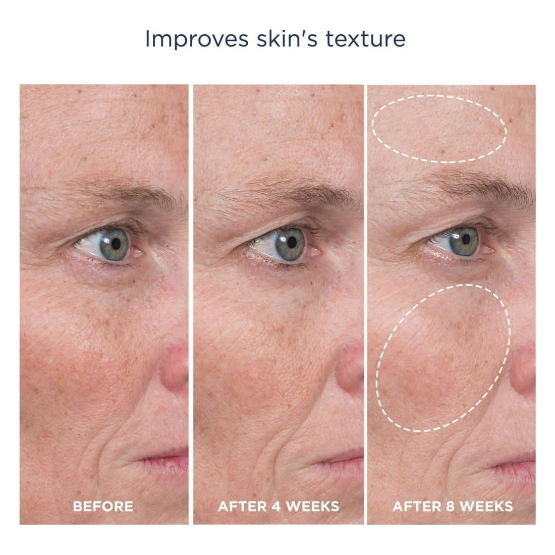 M-61 Advanced Essentials Four Step Skincare System | Clinically Proven Glow-Boosting Regimen