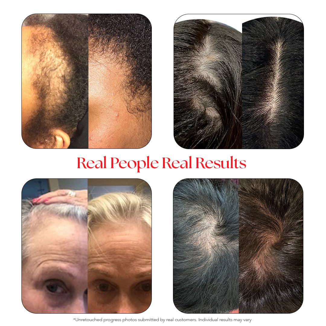 HAIRtamin Gorgeous Growth Scalp Serum - 60ml | Thicker-Looking Hair & Healthier Scalp with Niacinamide + Aloe Vera