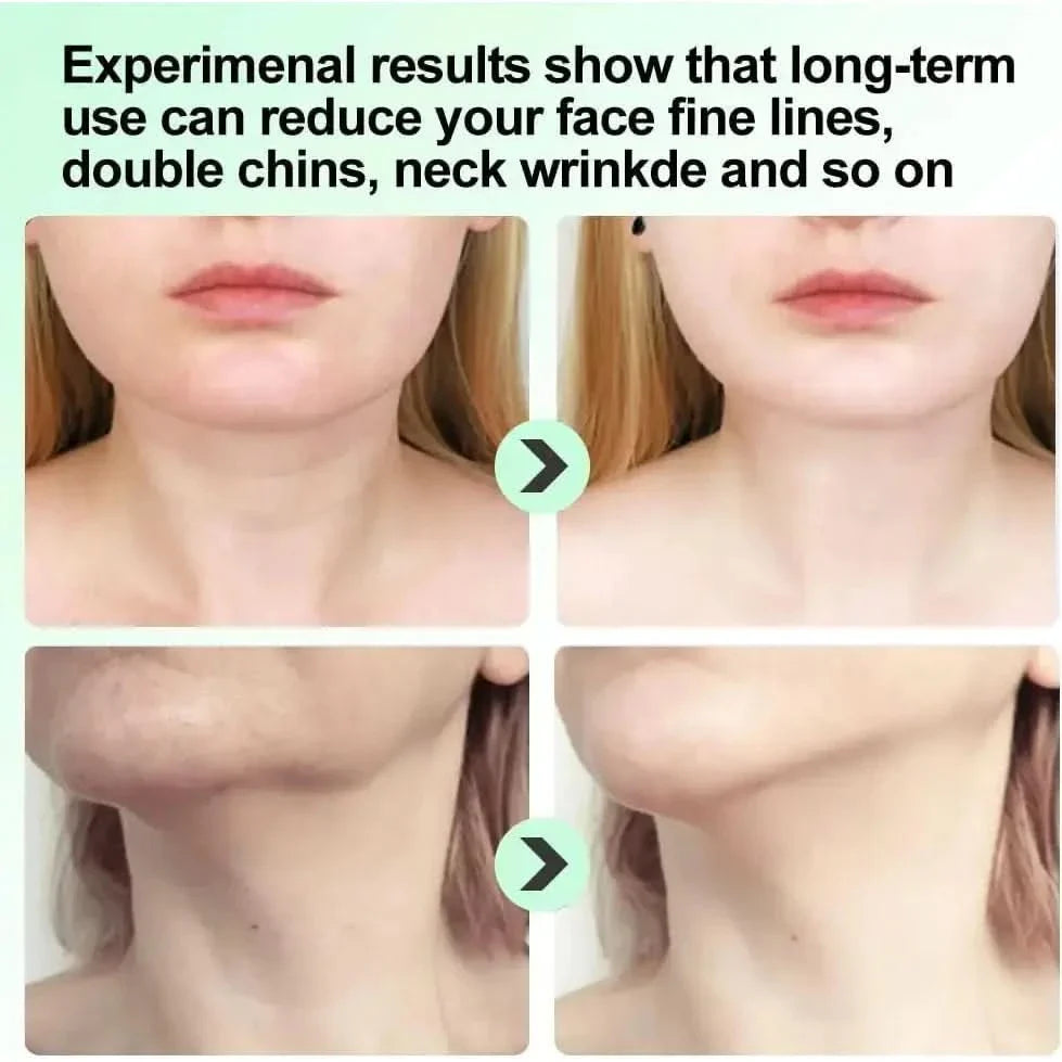 Anti-Wrinkle & Aging Face Massager Your Secret to Youthful, Radiant Skin