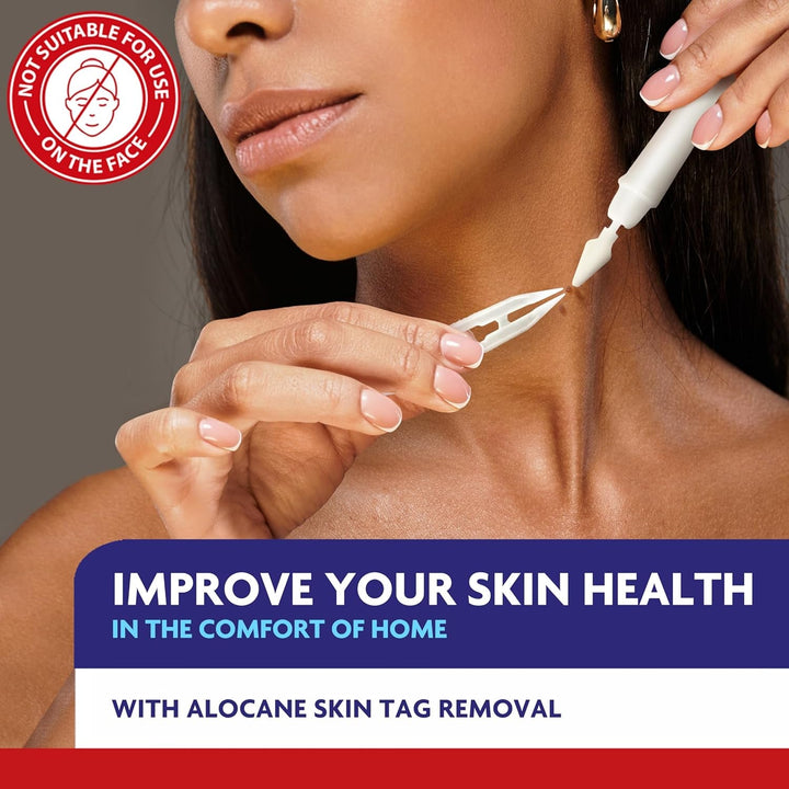 ALOCANE Precision Freeze Skin Tag Remover 80ml | FDA-Cleared Cryotherapy for Safe At-Home Skin Tag Removal