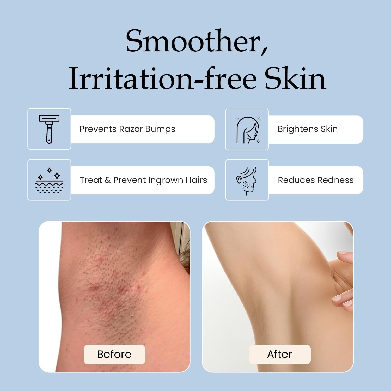 ESTETIST Razor Bump Stopper (Original Scent) - 90ml | Ingrown Hair & Dark Spot Solution