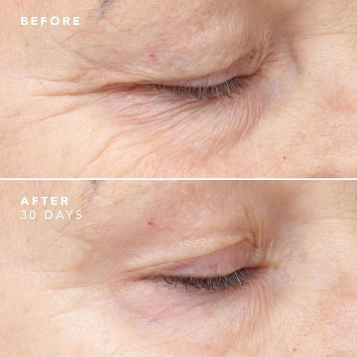 BIOEFFECT 30 Day Treatment | Intensive Anti-Ageing Serum for Smoother, Firmer & More Radiant Skin BIOEFFECT