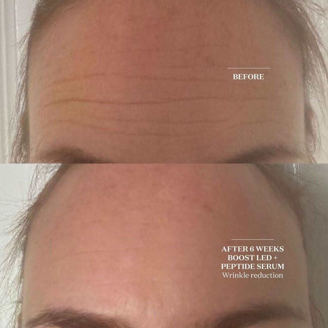 The Light Salon Boost LED Mask | Clinically Proven Skin Rejuvenation