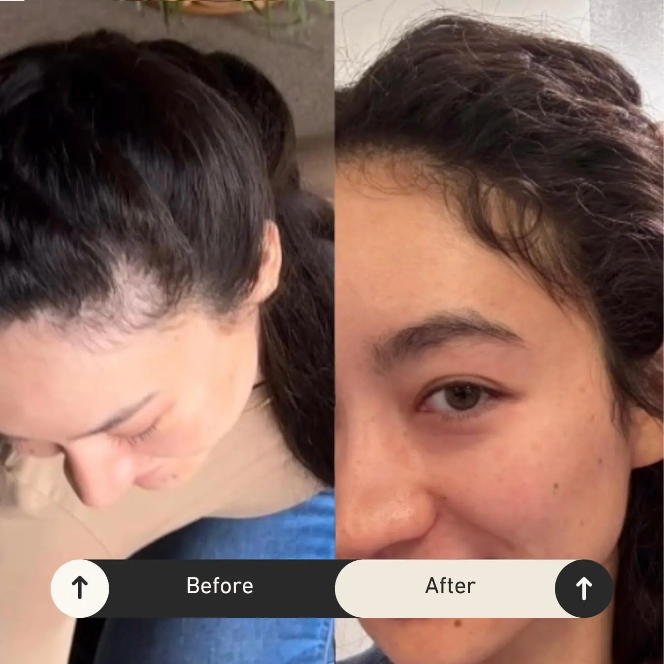 Bur Bur Growing Season Botanical Hair Growth Oil – 50ml | Strengthen, Repair & Boost Natural Hair Growth