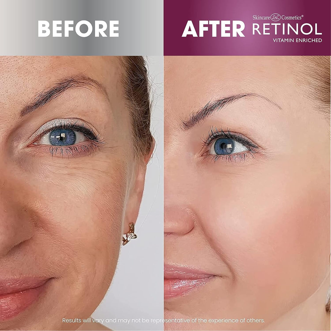Skincare L&L Cosmetics Retinol Super Face Lift 30g | Instant Firming Treatment for Face, Neck & D¨¦colletage