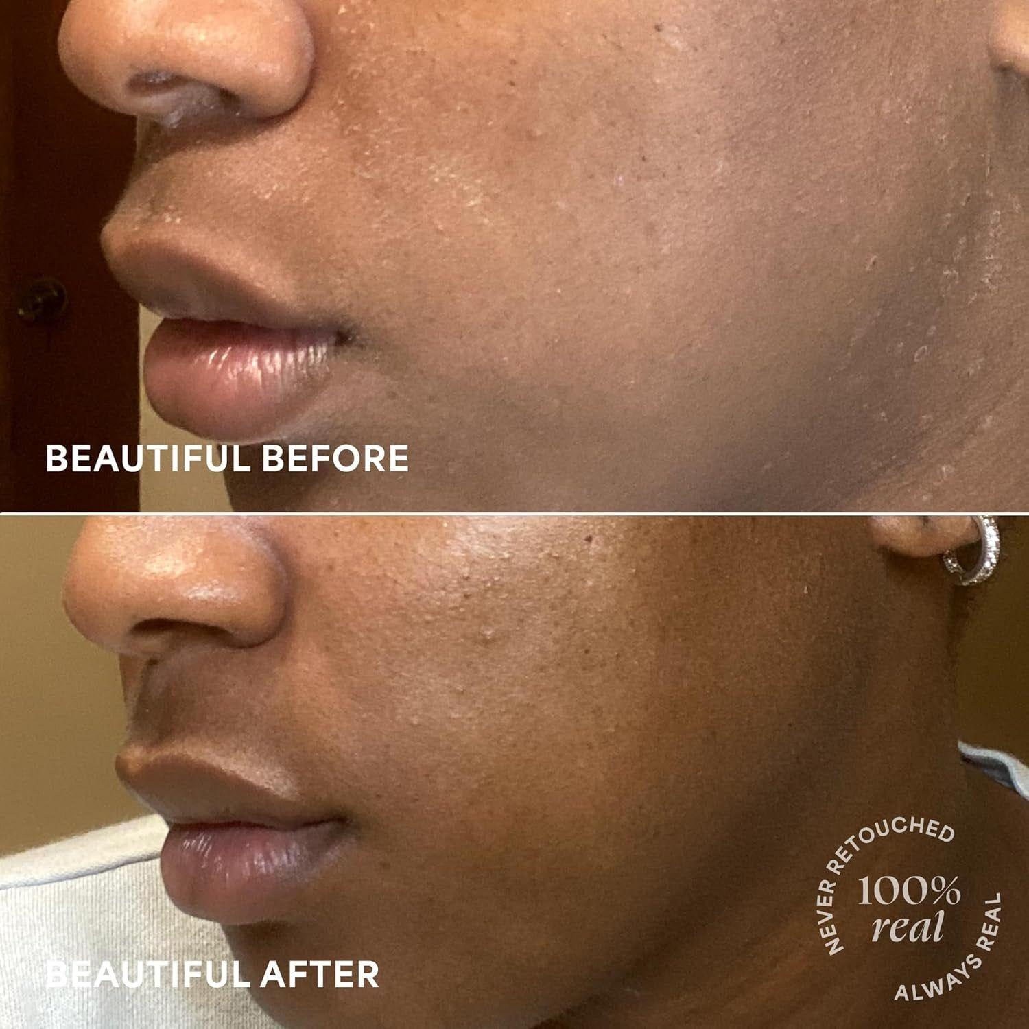 TULA SKINCARE 24-7 Moisture Intense Ultra Hydrating Day & Night Cream (Regular) - 43g | Deep Hydration & Skin Barrier Support