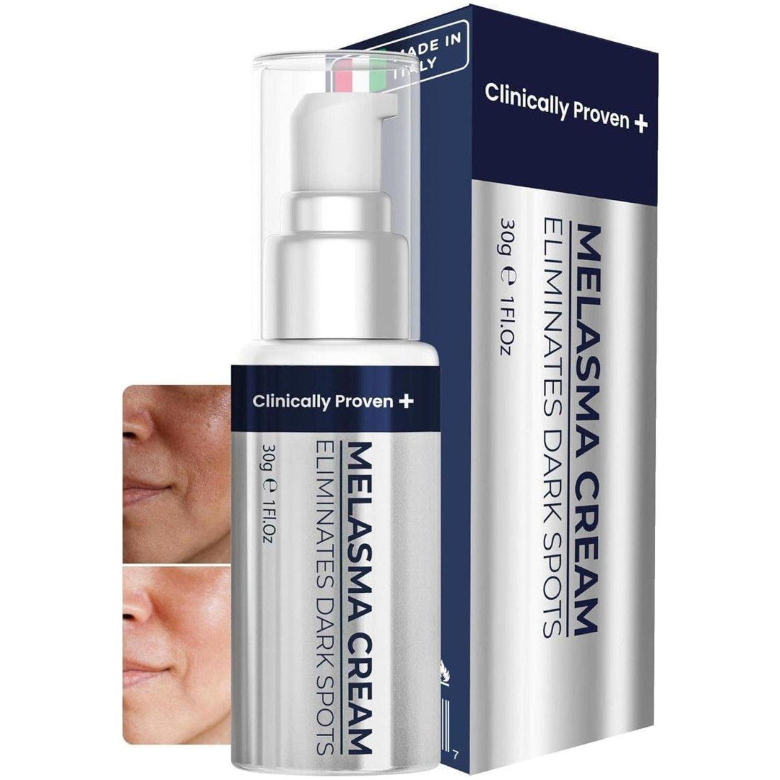 Clinically Proven + Melasma Cream | Advanced Dark Spot & Hyperpigmentation Treatment from Italy Clinically Proven +