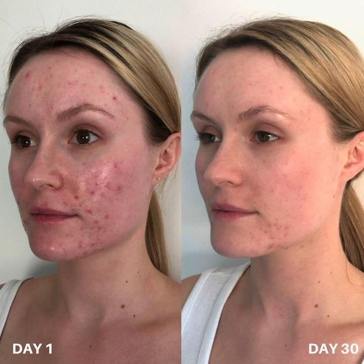 Clinisoothe+ Skin Purifier 250ml Advanced Skin Protection & Purification