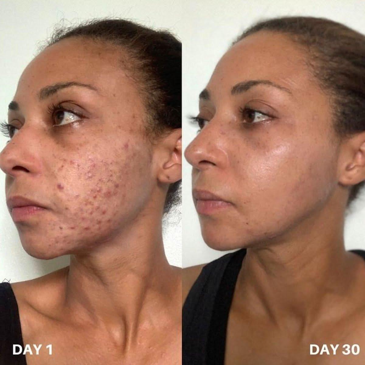 Clinisoothe+ Skin Purifier 250ml Advanced Skin Protection & Purification