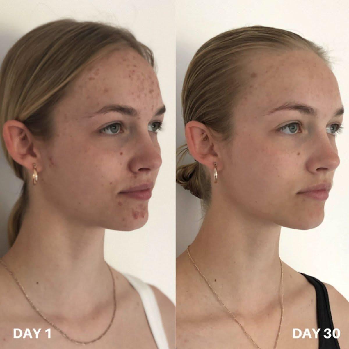 Clinisoothe+ Skin Purifier 250ml Advanced Skin Protection & Purification