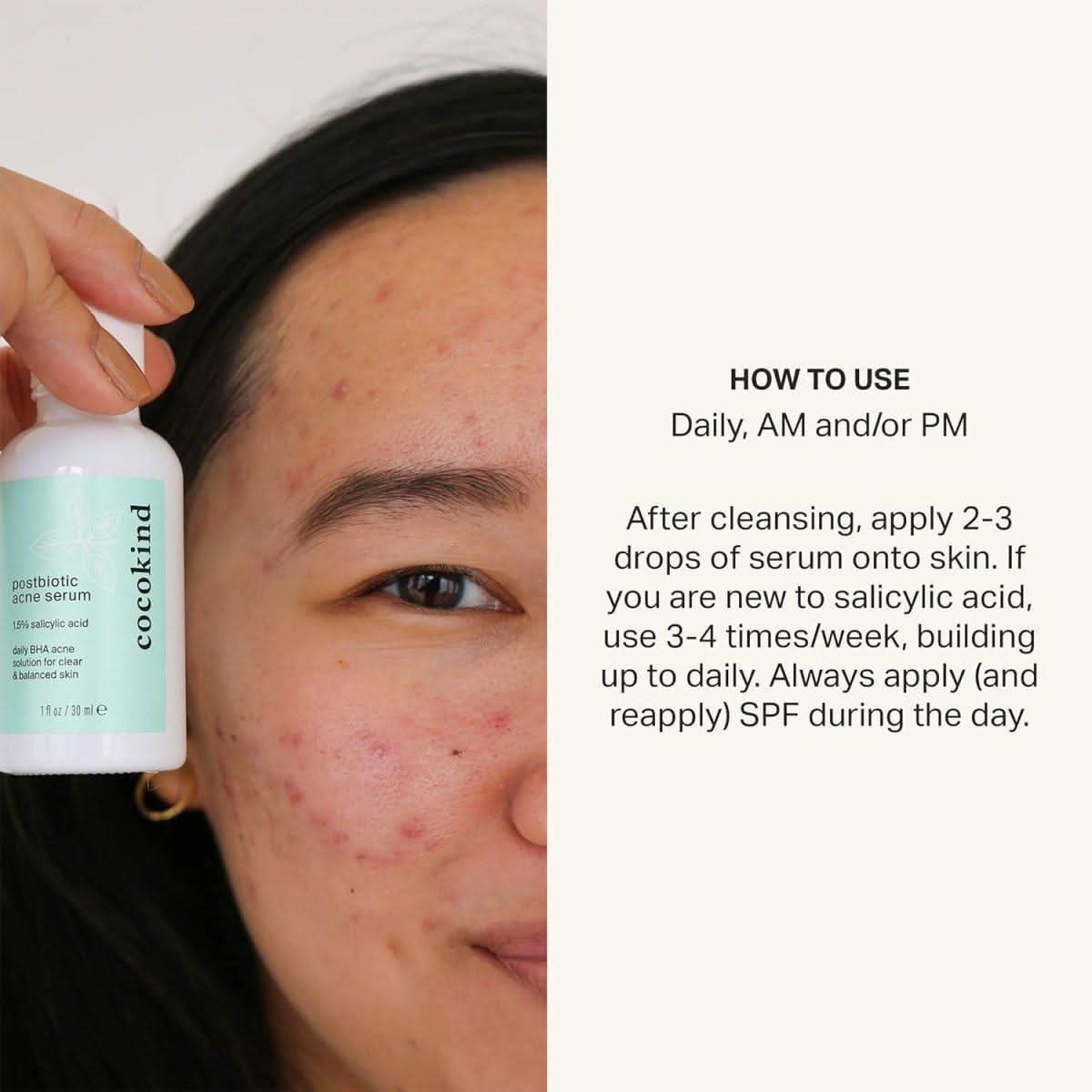 Cocokind Postbiotic Acne Serum 30ml | BHA + Postbiotic Clarifying Treatment