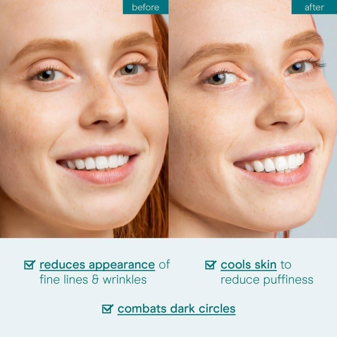 Baebody Eye Gel 50ml (Large) | Hydrating, Firming & Anti-Aging Formula Baebody